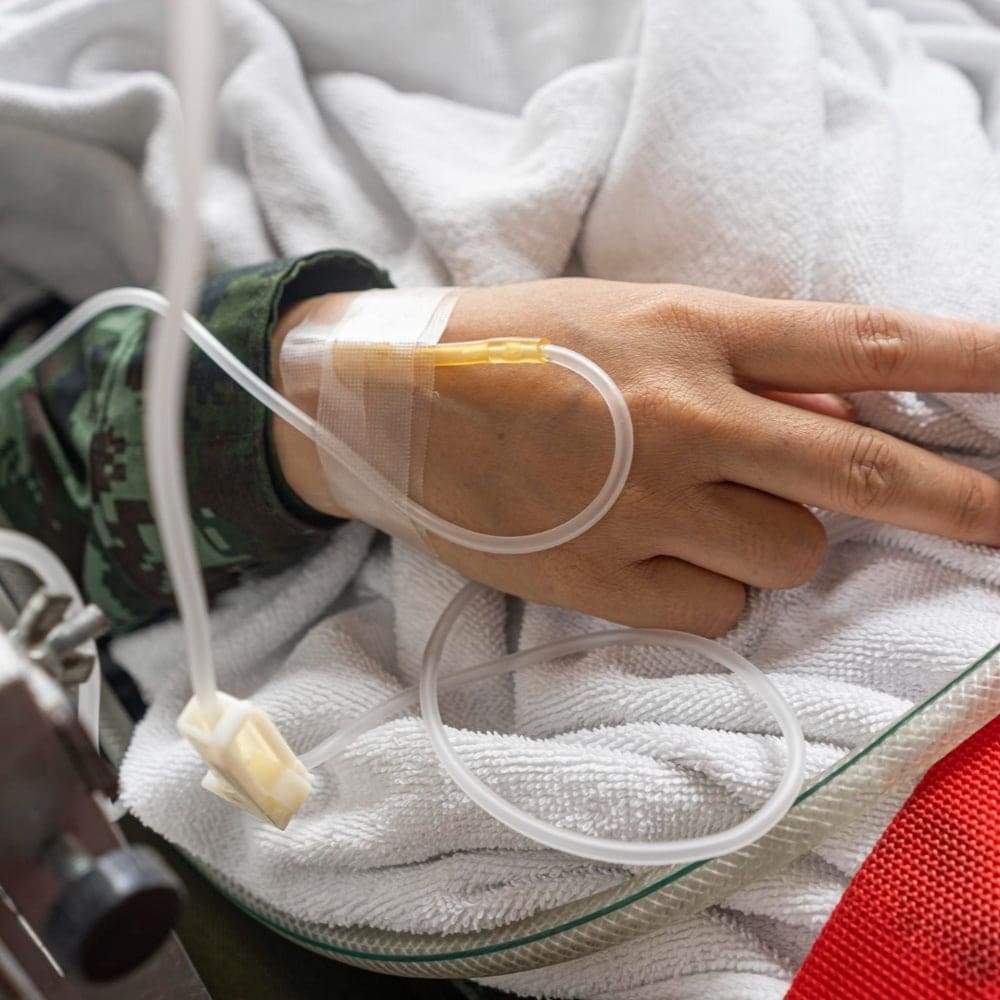 Enteral feeding Enteral feeding