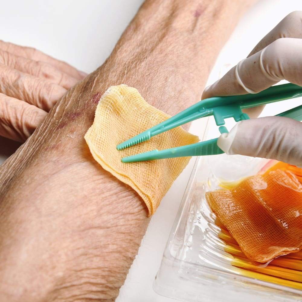 Wound care Wound care - Complex care